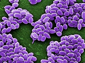 Spores from the Sterne strain of anthrax bacteria (Bacillus anthracis) are pictured in this handout scanning electron micrograph (SEM) obtained by Reuters May 28, 2015. The U.S. military mistakenly sent live anthrax bacteria to laboratories in nine U.S. states and a U.S. air base in South Korea, after apparently failing to properly inactivate the bacteria last year, U.S. officials said on May 27, 2015. REUTERS/Center for Disease Control/Handout via Reuters