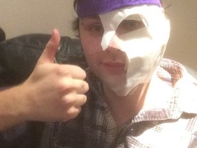 5 Seconds of Summer guitarist Michael Clifford posts a photo of himself following a protechnic mishap at a concert. (Instagram)