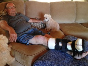 Manuel DaCunha is pictured wearing a full contact cast his wife says helped heal a diabetic foot ulcer he was suffering from for four years. The couple are questioning why his casting wasn't covered by OHIP. (Handout/Sarnia Observer/Postmedia Network)