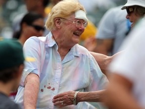 A fan with a bandage on her forehead and blood stain on her shirt smiles after being hit by a broken bat during a game between the Athletics and Rockies at O.co Coliseum in Oakland, Calif., on July 1, 2015. (Kelley L Cox/USA TODAY Sports)