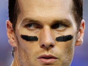 New England Patriots quarterback Tom Brady takes his helmet off during warm-ups ahead of the start of the NFL Super Bowl XLIX football game against the Seattle Seahawks in Glendale, Arizona, in this February 1, 2015 file photo. (REUTERS/Lucy Nicholson/Files)