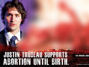 The flyer itself includes a picture of an aborted fetus and of Trudeau.

It includes a statement that says Trudeau supports abortion until birth and “a vote for Justin Trudeau is a vote for this,” referring to the picture.