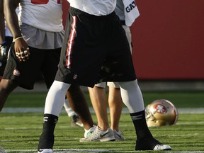 San Francisco 49ers linebacker Aldon Smith lifts his jersey during the team's training camp in Santa Clara, Calif., on Saturday, Aug. 1, 2015. Smith was arrested Thursday and is accused of hit and run, drunken driving and vandalism. (Jeff Chiu/AP Photo)