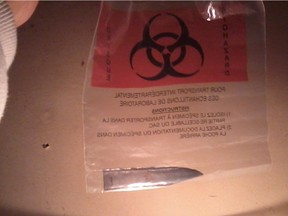 A knife is shown in this handout photo taken in Yellowknife on Monday, March 20, 2013. A man from the Northwest Territories has filed a lawsuit against health officials claiming they failed to find a knife blade buried in his back for three years. (THE CANADIAN PRESS/HO - Billy McNeely)