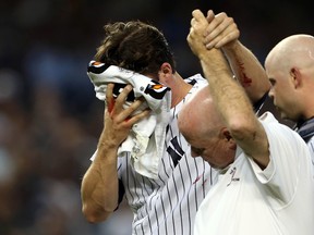New York Yankees pitcher Bryan Mitchell is helped off the field after being hit in the face by a baseball against the Minnesota Twins during the second inning at Yankee Stadium Monday. (Adam Hunger/USA TODAY Sports)