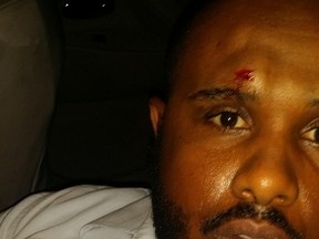 Taxi driver Mohamed Elfadli shows a gash on his head from where he was allegedly punched.