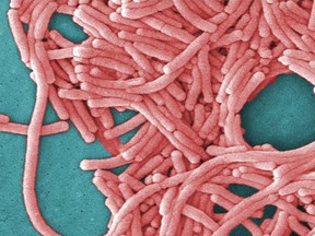 A large grouping of Legionella pneumophila bacteria (Legionnaires' disease). Legionnaires' disease has been reported in a handful of states in the summer of 2015, leading to multiple deaths and more than 100 illnesses. (Janice Haney Carr/Centers for Disease Control and Prevention via AP, File)