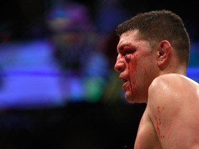 Nick Diaz stands in the octagon after taking a hit from Anderson Silva in a middleweight bout against Anderson Silva during UFC 183 at the MGM Grand Garden Arena in Las Vegas on January 31, 2015.. (Steve Marcus/Getty Images/AFP)