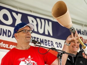 Organizer Darrin Park speaks about Terry Fox while holding up a replica of the runner's prosthetic leg during the 35th annual Terry Fox Run at Hawrelak Park in Edmonton, Alta., on Sunday September 20, 2015. The run is held in memory of Terry Fox and his 1980 Marathon of Hope, and raises funds for the Terry Fox Foundation's fight against cancer.