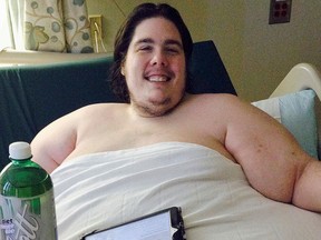 In this Monday, Oct. 12, 2015 photo, Steven Assanti, 33, rests in bed at Kent Hospital in Warwick, R.I. Assanti, of Cranston and who weighs 778 pounds, said he was kicked out of another hospital for ordering pizza. (AP Photo/Jennifer McDermott)