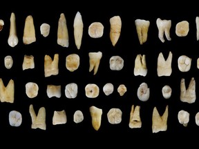 Forty-seven human teeth found in the Fuyan Cave in Hunan Province in China are pictured in this undated handout photo obtained by Reuters Oct. 14, 2015.  REUTERS/S. Xing and X-J. Wu/Handout