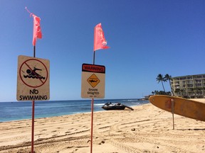 Signs warning of a shark sighting are posted at Makaha Beach Park in Waianae, Hawaii, Thursday, Oct. 29, 2015. A 10-year-old boy was bitten by a shark at the Oahu beach on Wednesday. (AP Photo/Audrey McAvoy)