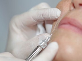More and more women are opting to get fillers for their face as part of a regular routine. (Fotolia)