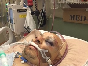 Rodrigo Almonacid Gonzalez is pictured in the hospital in this undated handout photo. (Handout/Postmedia Network)