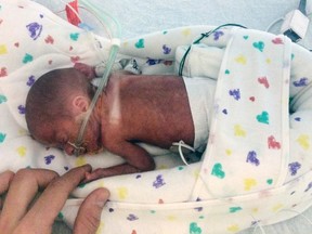 In this Sept. 11, 2015 file photo provided by Emily Morgan, Chase Morgan holds his son Haiden's hand at the Miami Children's Hospital. Baby Haiden Morgan, who has spent the past two months in the Miami hospital after his premature birth on a cruise ship, and his mother, Emily Morgan, arrived home in Ogden, Utah on Saturday night, Nov. 21, 2015, after a flight that included medical equipment to ensure safe transport. (Emily Morgan via AP, File)