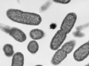 Electron micrograph images of E.coli are shown. MCR-1, a gene that makes bacteria resistant to the killing effects of antibiotics, has been detected in a patient in Ottawa, as well as several other sources.THE CANADIAN PRESS/HO-Brian Coombes Laboratory, McMaster University