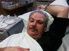 Allen Orr is recovering at home after being attacked while he walked his wife to work in Napanee, Ont. on Wednesday January 6, 2016. (Courtesy of Allen Orr)