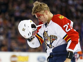 Panthers centre Nick Bjugstad (27) leaves the ice covered in blood after a fight with Edmonton defenceman Eric Gryba (62) during the first period of a NHL game between the Edmonton Oilers and the Florida Panthers at Rexall Place in Edmonton, Alta. on Sunday January 10, 2016. Ian Kucerak/Edmonton Sun/Postmedia Network