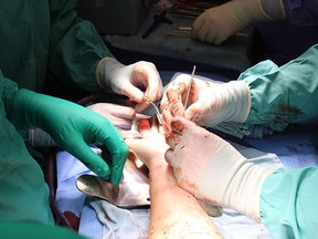 Doctors perform a hand transplant procedure at Toronto Western Hospital in Toronto in this undated handout photo. THE CANADIAN PRESS/HO - University Health Network