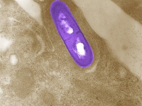 An electron micrograph of a Listeria bacterium in tissue is seen in a 2002 image from the Centers for Disease Control and Prevention (CDC). REUTERS/Elizabeth White/CDC/Handout via Reuters