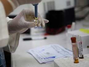 Blood samples from pregnant women are analyzed for the presence of the Zika virus at Guatemalan Social Security maternity hospital in Guatemala City, Tuesday, Feb. 2, 2016. (AP Photo/Moises Castillo)