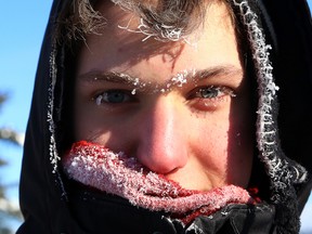 Emerick Lalonde's eyebrows, eyelids and hair is covered in frost while playing jug curling on the outdoor rink at the Beaver Lake Winter Carnival at the Beaver Lake Sports and Cultural Club in Worthington, Ont. on Saturday February 13, 2016. The three-day carnival, which wrapped up on Sunday, featured food, refreshments, live entertainment, live animal show, kid zone, Finnish pancake breakfast, penny table and silent auction, winter photo competition and outdoor games. John Lappa/Sudbury Star/Postmedia Network