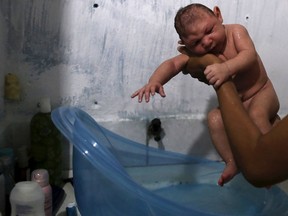 Daniele Santos, 29, holds her son Juan Pedro who is 2-months-old and born with microcephaly, after bathing him at their house in Recife, Brazil, February 9, 2016.  (REUTERS/Nacho Doce)