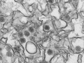 A transmission electron micrograph of the Zika virus. (Wikimedia Commons/CDC/HO)