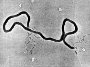 The organism treponema pallidum, which causes syphilis, is seen through an electron microscope. Las Vegas is experiencing a syphilis outbreak, as health officials warn of a national spike in cases. (AP Photo, File)