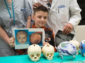 EDMONTON, AB. MARCH 17, 2016 - Brandt Johner of Grimshaw, made medical history in 2006 as a two-month-old who had first-in-Canada minimally invasive skull surgery. Dr. Vivek Mehta perfumed the first  surgical method of its kind in Canada on the boy whose newborn skull bones had fused together too early. Shaughn Butts / POSTMEDIA NEWS NETWORK