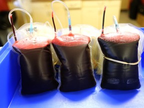 Units of donated blood are shown at the Canadian Blood Services Calgary blood donor clinic in Calgary, Alta on Tuesday July 28, 2015.Jim Wells/Calgary Sun/Postmedia Network