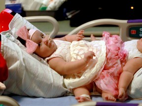 This Feb. 10, 2016 photo provided by Driscoll Children's Hospital shows conjoined twin sisters Scarlett, left, and Ximena Hernandez-Torres at Dirscoll Children's Hospital in Corpus Christi, Texas. Doctors in Texas will attempt to separate the two 10-month-old sisters born conjoined below the waist. The girls share a colon and bladders that will be reconstructed. Their identical triplet sister, Catalina, was born without serious health issues. (Joshua Thelin/Driscoll Children's Hospital via AP)