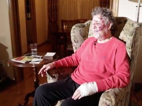 Richard Suter talks from his home in southwest Edmonton on January 24, 2015 about being abducted, beaten and getting his thumb cut off.