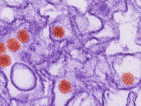 A transmission electron micrograph (TEM) of Zika virus, which is a member of the family Flaviviridae is seen in this undated image from the Centers for Disease Control (CDC). REUTERS/Centers for Disease Control/Handout