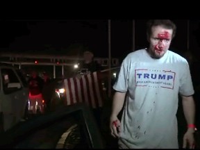 This still image taken from video shows a supporter of Republican presidential candidate Donald Trump after a protest on Thursday, April 28, 2016 in Costa Mesa, Calif. (APTN via AP Photo)
