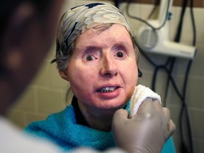 Charla Nash smiles as her care worker washes her face at her apartment in Boston Friday, Feb. 20, 2015. Nash lost her face, eyes and hands after being mauled by a chimpanzee in 2009. (AP Photo/Charles Krupa)
