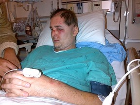 Ryan Turcotte is seen after the June 26, 2012 attack.