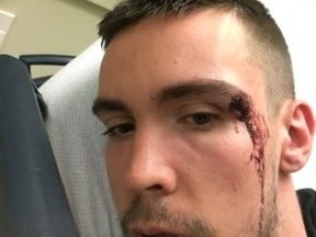 Christopher Richards claims he suffered this injury at the hands of TTC officers.