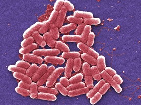This 2006 colorized scanning electron micrograph image made available by the Centers for Disease Control and Prevention shows the O157:H7 strain of the E. coli bacteria. On Wednesday, May 26, 2016, U.S. military officials reported the first U.S. human case of bacteria resistant to an antibiotic used as a last resort drug. The 49-year-old woman has recovered from an infection of E. coli resistant to colistin. But officials fear that if the resistance spreads to other bacteria, the country may soon see germs impervious to all antibiotics. (Janice Carr/CDC via AP)
