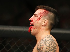 Thomas Almeida reacts between rounds during his bantamweight fight with Brad Pickett at UFC 189 on Saturday, July 11, 2015, in Las Vegas. (AP Photo/John Locher)