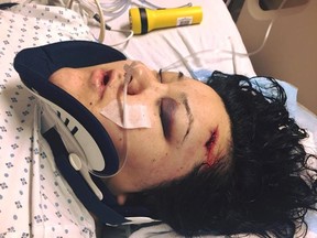 A brutal beating at the Behavioural Health Foundation left Red River College intern Jackie Healey with a fractured skull, broken teeth, and losing 99% of the vision in her left eye.