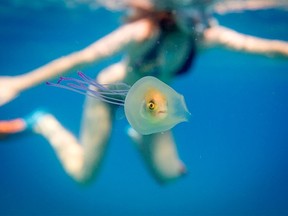 This undated handout picture taken by Tim Samuel and provided through his Instagram account shows a small fish swimming inside the belly of a jellyfish off the coast of Byron Bay in New South Wales, eastern Australia. A fish has been pictured swimming inside a jellyfish off Australia's east coast in a remarkable and rare image that has gone viral, with more than two million online views. Underwater photographer Tim Samuel was in the water with a friend near popular tourist resort Byron Bay in December when they came across the little creature trapped inside the only slightly larger jellyfish. (AFP PHOTO/instagram.com/timsamuelphotography/Tim Samuel Photography)