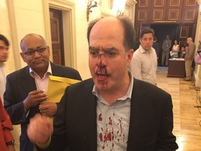 In this photo provided by Elyangelica Gonzalez, Venezuelan opposition Congressman Julio Borges arrives to the National Assembly after he was attacked by government supporters during a protest outside the National Electoral Council, CNE, in Caracas, Venezuela, Thursday, June 9, 2016. Opposition members were turned back from the headquarters of Venezuela's electoral body where the group attempted to enter to demand the government allow it to pursue a recall referendum against President Nicolas Maduro. (Elyangelica Gonzalez via AP)