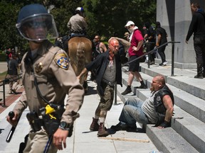 A wounded man stands by another wounded man sitting on the steps of the California state Capitol after members of right-wing extremists groups holding a rally outside the state Capitol building clashed with counter-protesters in Sacramento, Calif., Sunday, June 26, 2016. (Paul Kitagaki Jr./The Sacramento Bee via AP)