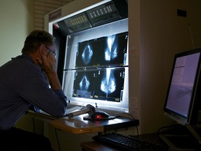 Radiologists billed the Alberta government nearly $364 million last year.