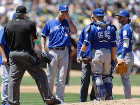 Blue Jays pitcher J.A. Happ reacts after being hit on the arm in the fifth inning in Oakland on July 17, 2016. (BEN MARGOT/AP)