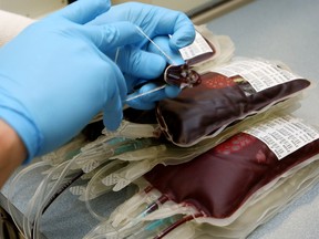 Blood after filtering out the white blood cells. Bruce Edwards/Postmedia