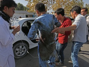 Afghans help a man who was injured in a deadly explosion that struck a protest march by ethnic Hazaras, in Kabul, Afghanistan, Saturday, July 23, 2016. (AP Photo/Rahmat Gul)