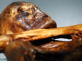The mummy of an iceman named Oetzi, discovered in 1991 in the Italian Schnal Valley glacier, is displayed at the Archaeological Museum of Bolzano on Feb. 28, 2011. (Andrea Solero/AFP/Getty Images)