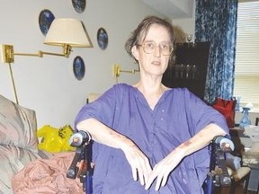 Kevin McSheffrey/Postmedia Network
More than a year ago, 57-year-old Beverley Mallyon was diagnosed with alpha 1 antitrypsin deficiency, a genetic disorder that causes major damage to vital organs: the lungs and/or the liver.